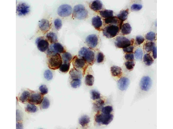 Immunocytochemistry of Anti-Annexin V